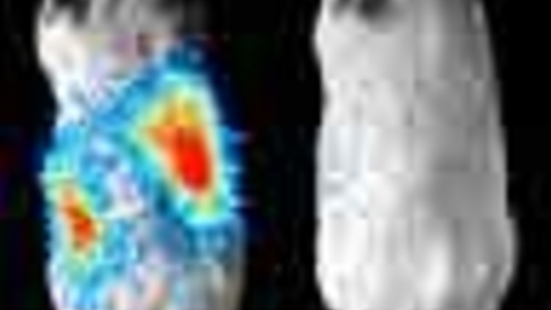 A New Light on Cancer