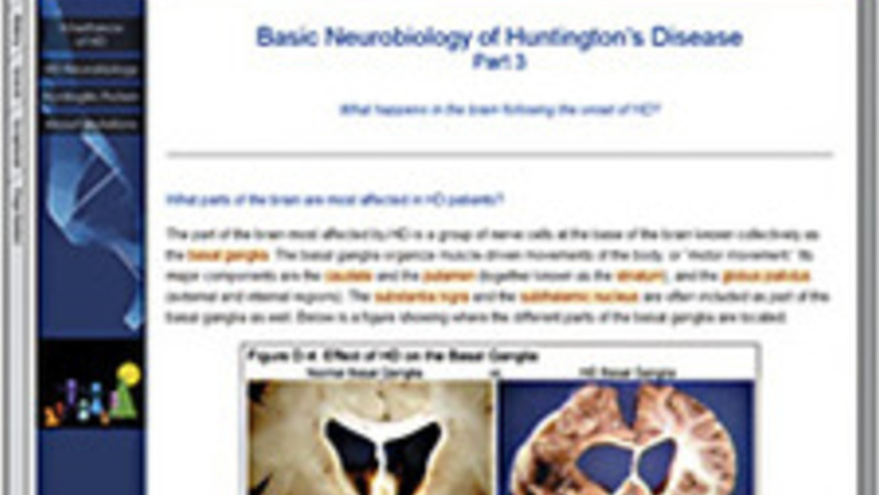 Explaining Huntington's
