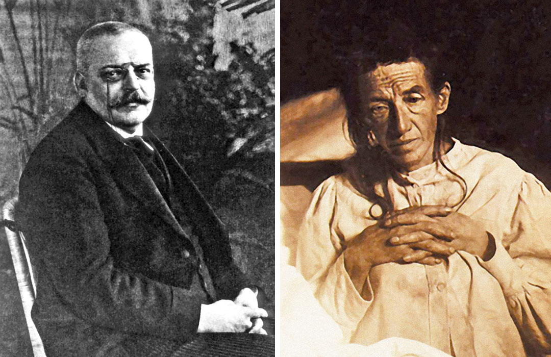 Alois Alzheimer, left, and his patient Auguste Deter, right.